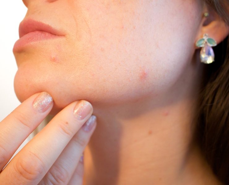 Best Skincare Advice For Women With Sensitive Skin