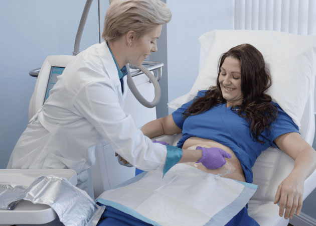coolsculpting in toronto