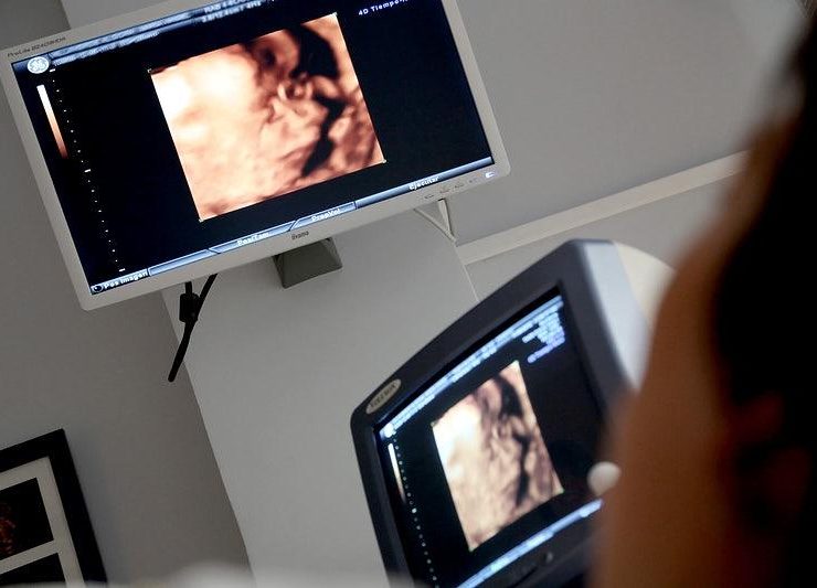 How To Choose The Right Ultrasound Equipment For My Practice