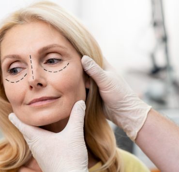 4 Things to Keep in Mind Before Undergoing Plastic Surgery